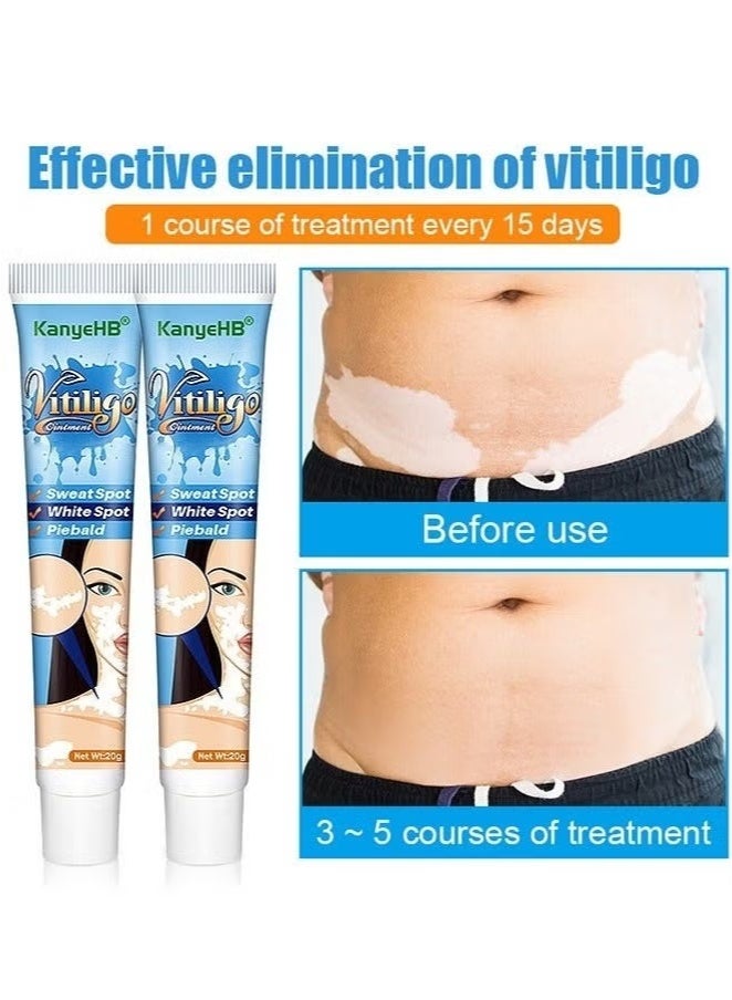 كاني إتش بي مرهم البهاق، علاج البهاق للبشرة، كريم العناية بالبهاق لتقليل البقع البيضاء وتحسين تصبغ الجلد 20 جرام - Image 3