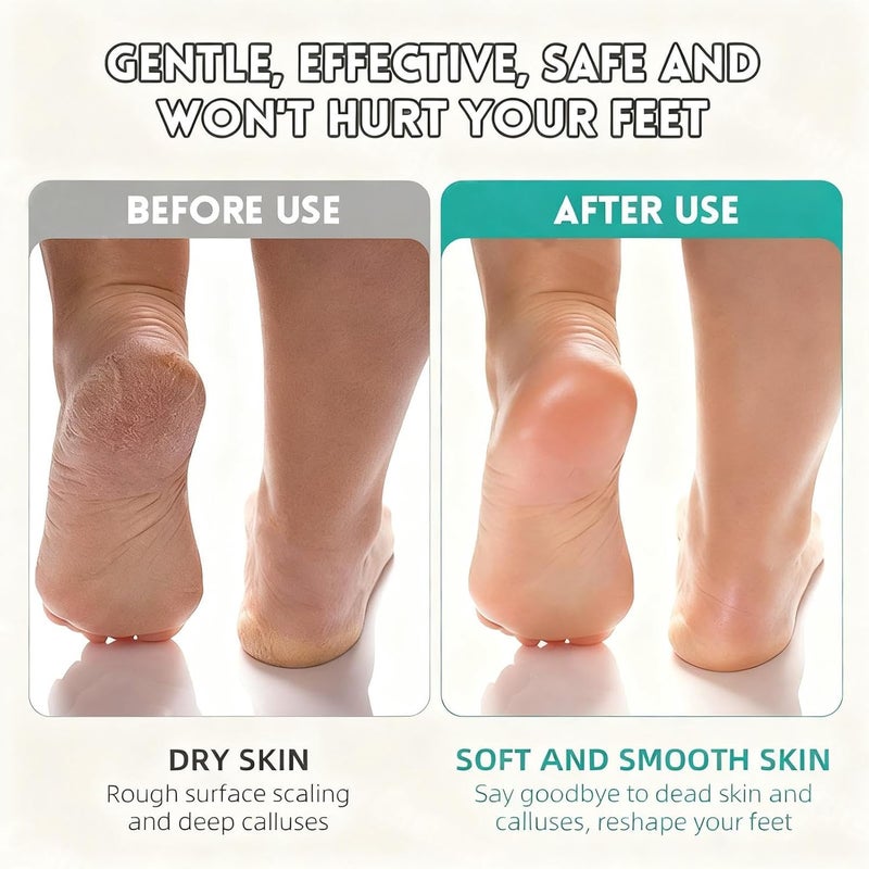 Foot Scrubber - Double-Head Cleaning Brush | Foot Scrubber Dead Skin Remover | for Hard Cracked Heels Corns Wet Dry Peeling Men Women Seniors Home Travel Shower Bath - Image 4