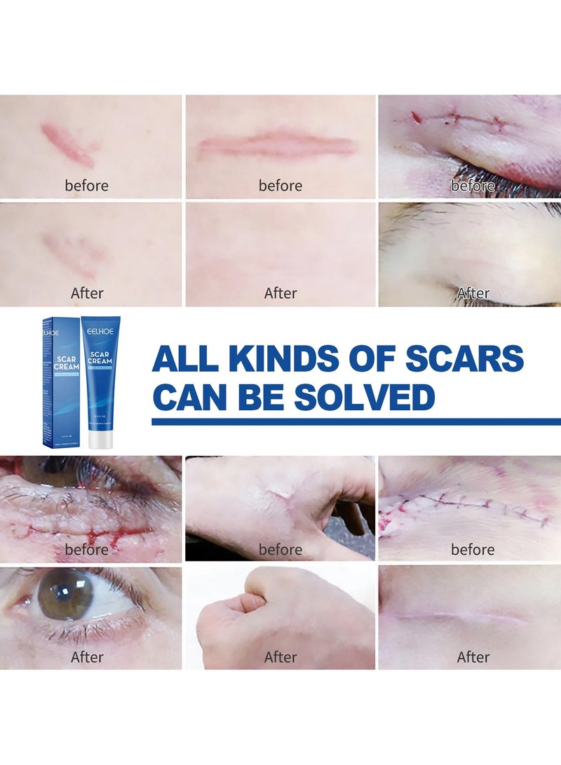 EELHOE Scar Cream - Image 2