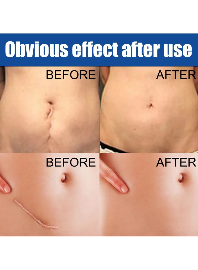 EELHOE Scar Cream - Image 4