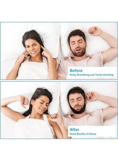 Ocean Anti Snore Chin Strap, Upgrade Anti Snoring Devices, Chin Straps Sleep Aids for Snoring Mouth Breather, Correction of Open Mouth Respiratory Resistance to Snoring Strap for Men and Women  - Image 2