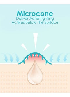 +1HEROLABS +1HEROLABS Microdart Acne Patch (54 Patches), Hydrocolloid Pimple Patches, Zit Patches, Pimple Patches for Face Salicylic Acid, Blemish Patches for Early Stage Deep Pimples (54 Count (Pack of 1))  - Image 4