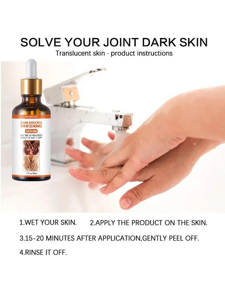 West&Month - Acanthosis Nigricans Therapy Oil, 50ml Strong Dark Knuckle Whitening Serum, Skin Brightening Dark Knuckles Remover Oil , Knuckle Whitening Cream Corrector For Knuckle Finger Elbow And Knee - Image 1
