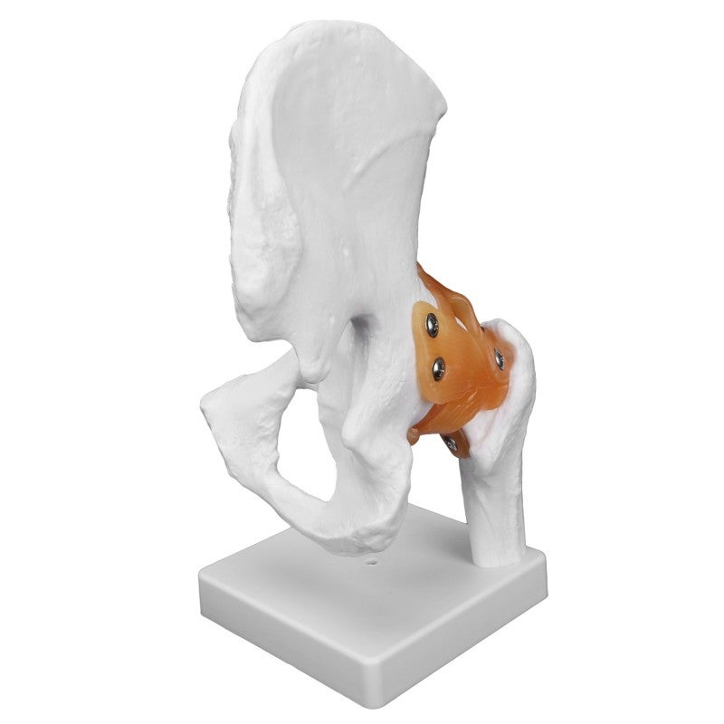 Life-Size Professional Hip Bone Model - High-Quality PVC Durable Structure Realistic Hip Joint Model for Orthopedic Surgeons and Medical Learners - Image 3