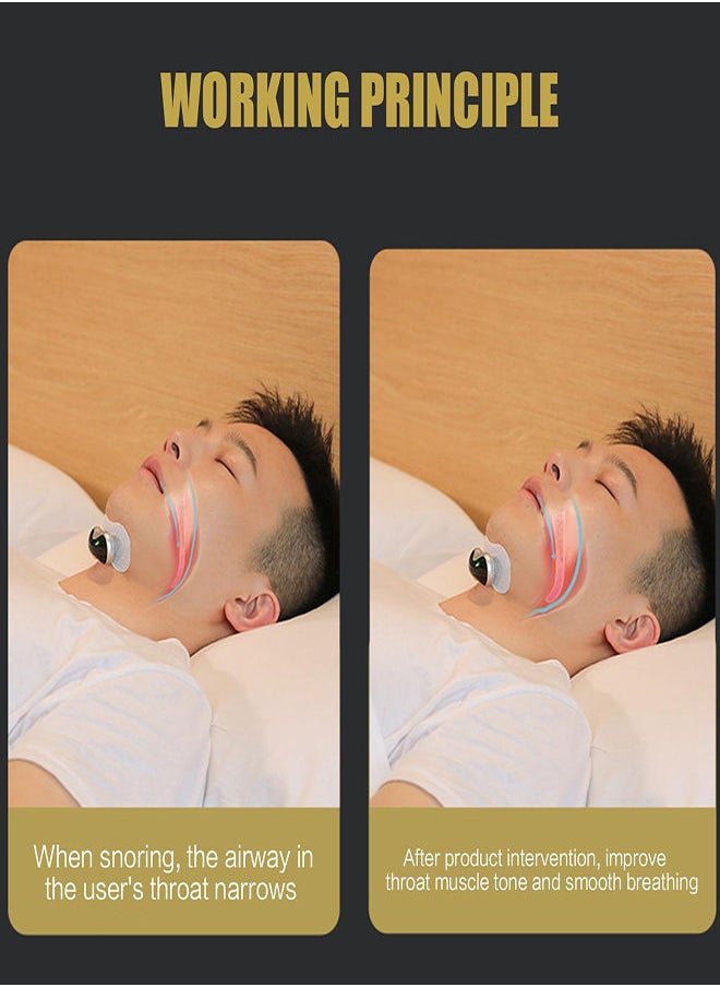 SYOSI - Smart Throat Anti-Snoring Device Pro, Electric Variable Speed Anti Snoring Device with 6-Speed Intensity Adjustment and TENS+EMA Double Pulse Technology, Mini Smart Portable Home Sleep Snore Stopper - Image 1