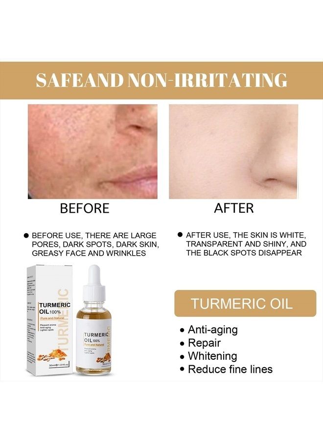 CROOT 2022 New Turmeric Dark Spot Corrector Serum，Natural Turmeric Dark Spot Corrector Serum for Face， Skin Care Moisturizing Serum(2PCS-60ml) - Image 3