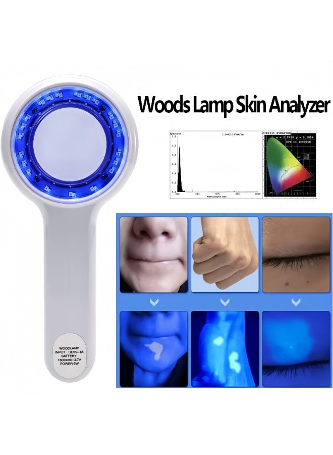Portable Professional Wood's Lamp Facial Skin Analyzer – 3x Magnification Diagnostic Tool for Dermatological Analysis and Skincare Assessment – ​​Rechargeable, White - Image 3