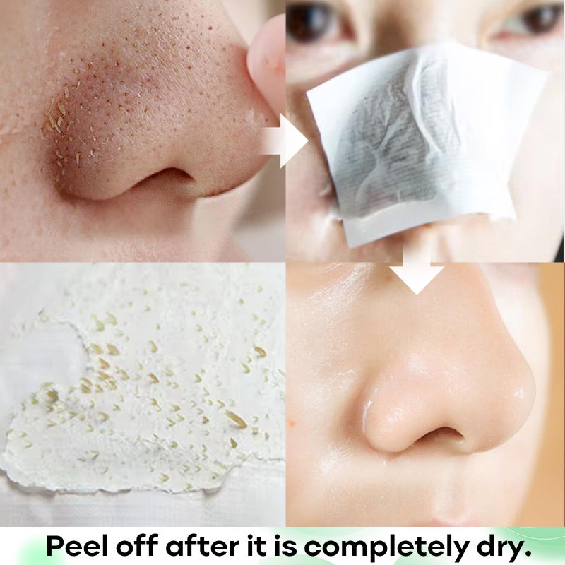 SYABO Blackhead Remover Peel Off Mask for Nose & Face - Blackhead Removal Kit with 100pcs Strips, Puntos Negros, 1.7oz - Image 3