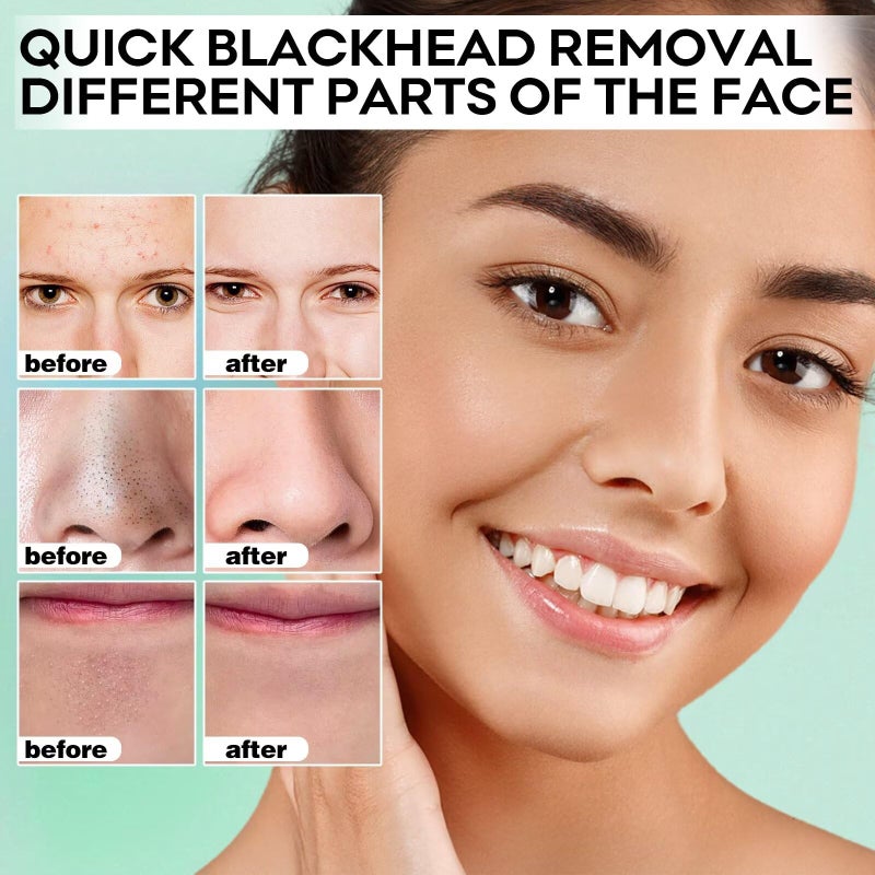 SYABO Blackhead Remover Peel Off Mask for Nose & Face - Blackhead Removal Kit with 100pcs Strips, Puntos Negros, 1.7oz - Image 4
