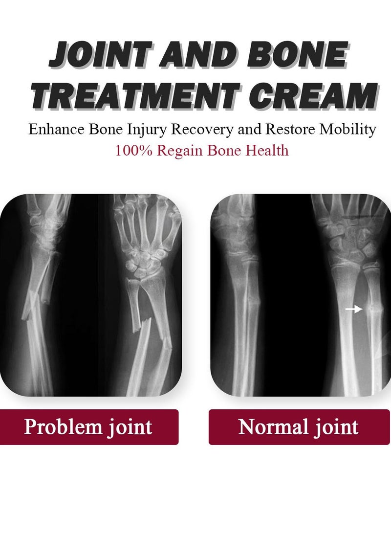 SOUTH MOON - Intensive Concentrate Cream Joint & Bone Therapy Collagen，Vitamin K2 & Msm - Image 1
