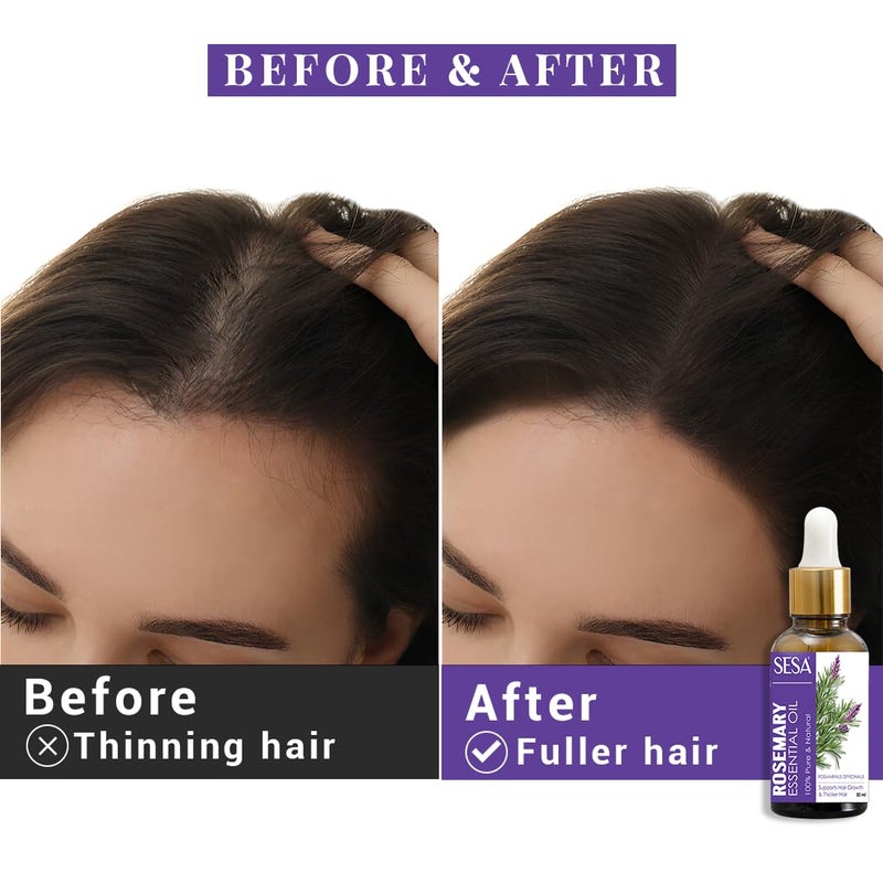 Sesa Rosemary Essential Oil For Hair Growth Nourishes Skin Hair Fall Control Oil For Women and Men 100 Pure Natural Rosemary Oil 30 ml - Image 5