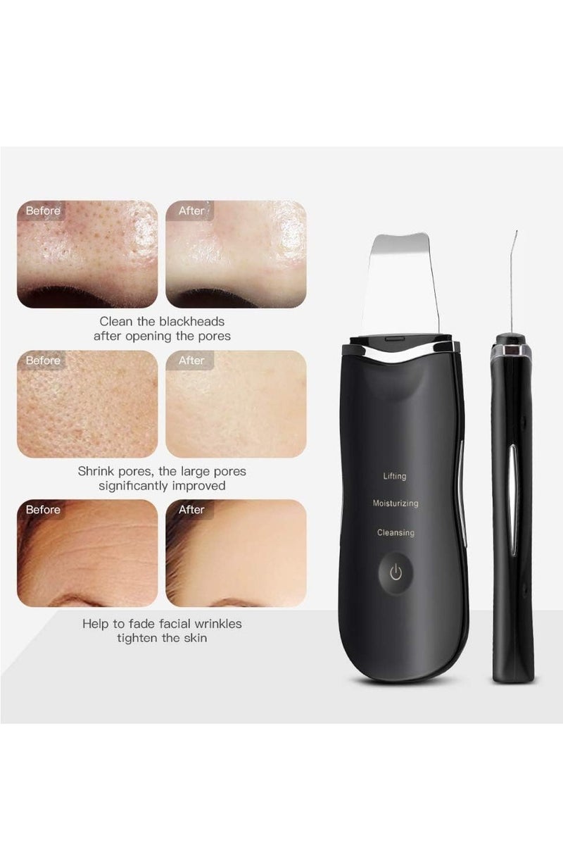 منجل الوجه لتنظيف الأيونات العميقة ومضغف التفحيم ومحاسبة التنظيف الشحنABLE ماساجر الجمال، جهاز إزالة البثور وإزالة حب الشمس وتقشير الرقي ومراقبة البشرة اللون الأبيض. - Image 4