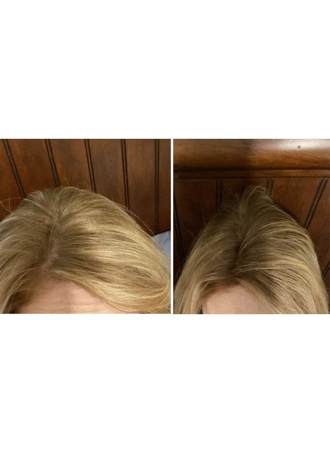 Caboki - Hair Loss Concealer. Allnatural Plantbased Hair Building Fiber. Covers Bald Spot And Thinning Hair. Makes Thin Hair Look 10X Fuller Instantly (30G 90Day Supply). Natural Blonde - Image 1