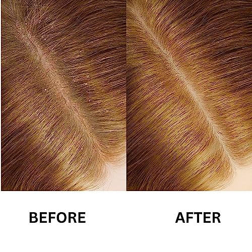 Argyana Hair Serum for Growth, Repair, Anti-Frizz and Styling - Nourishing and Strengthening Jasmine Scented Formula for Women (30 ml) - Image 5