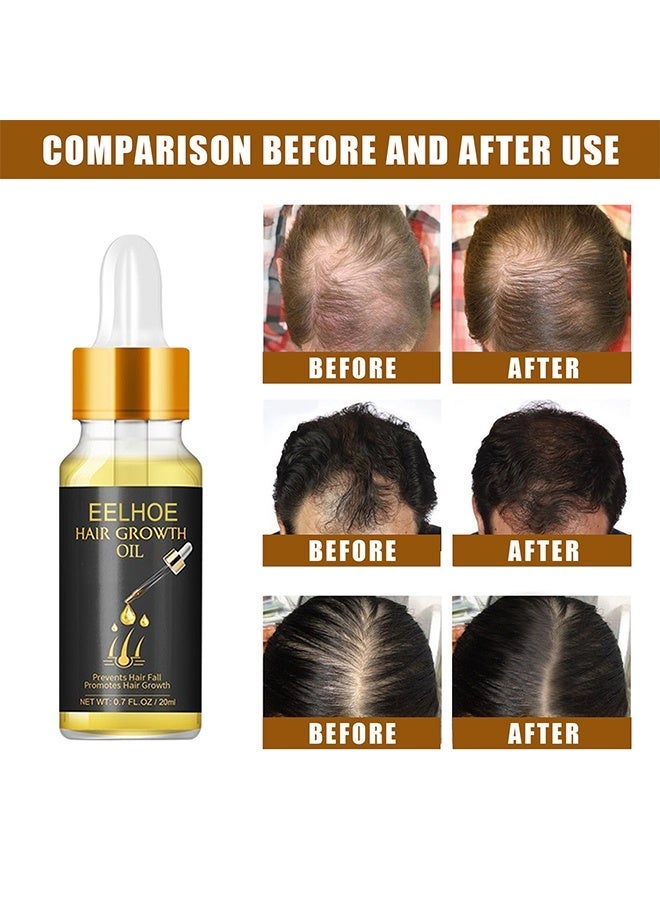 EELHOE Hair Growth Oil - Natural Biotin Hair Growth Oil Serum to Stimulate Hair Regrowth for Thicker Stronger Hair for Men & Women - Image 5