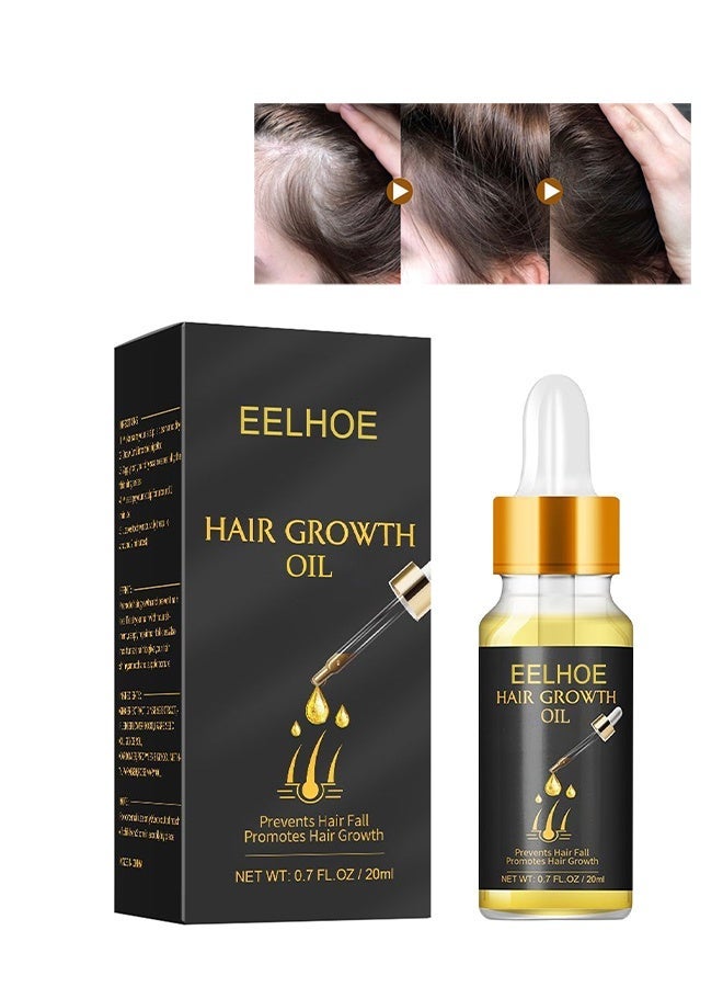 EELHOE Hair Growth Oil - Natural Biotin Hair Growth Oil Serum to Stimulate Hair Regrowth for Thicker Stronger Hair for Men & Women - Image 1