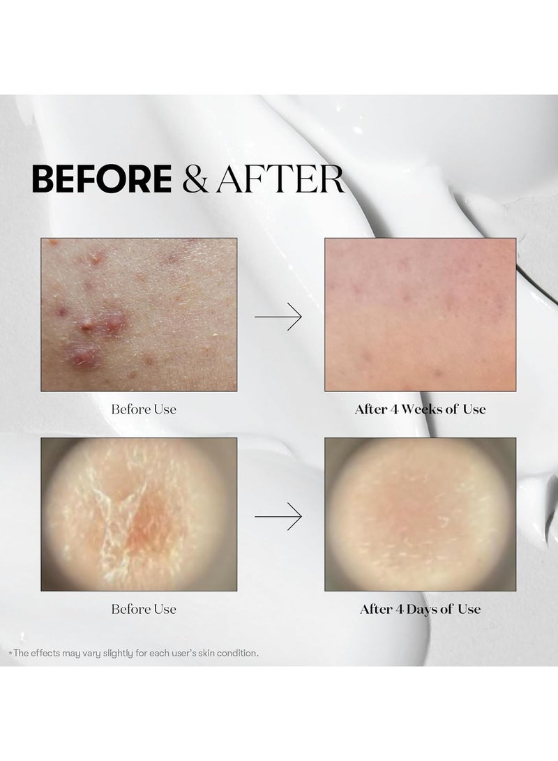 في تي كوزمتيكس مصل في تي كوسميتيكس ريدل شوت ١٠٠ - ٥٠ مل - Image 3