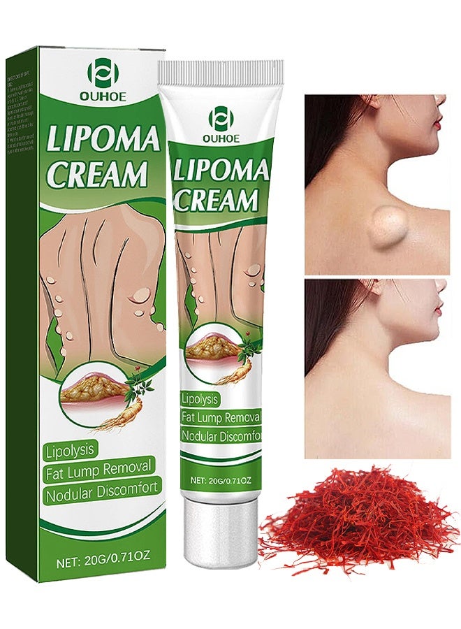 OUHOE Lipoma Cream For Unblock Various Fat Clumps In The Body - Image 1