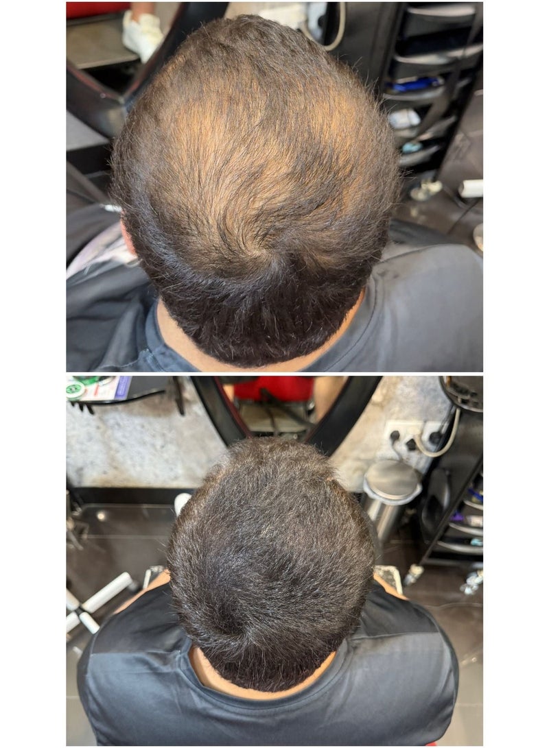 باتشي  مجموعة كريم خافي عيوب الشعر ضد الماء والتعرق بمكونات طبيعية للرجال والنساء 30مل + شامبو برو فيتامين المغذي بعمق 500مل - Image 3