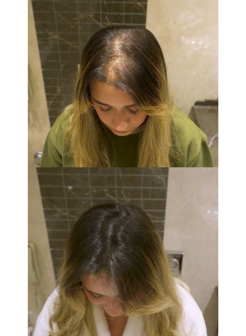 باتشي  مجموعة كريم خافي عيوب الشعر ضد الماء والتعرق بمكونات طبيعية للرجال والنساء 30مل + شامبو برو فيتامين المغذي بعمق 500مل - Image 2