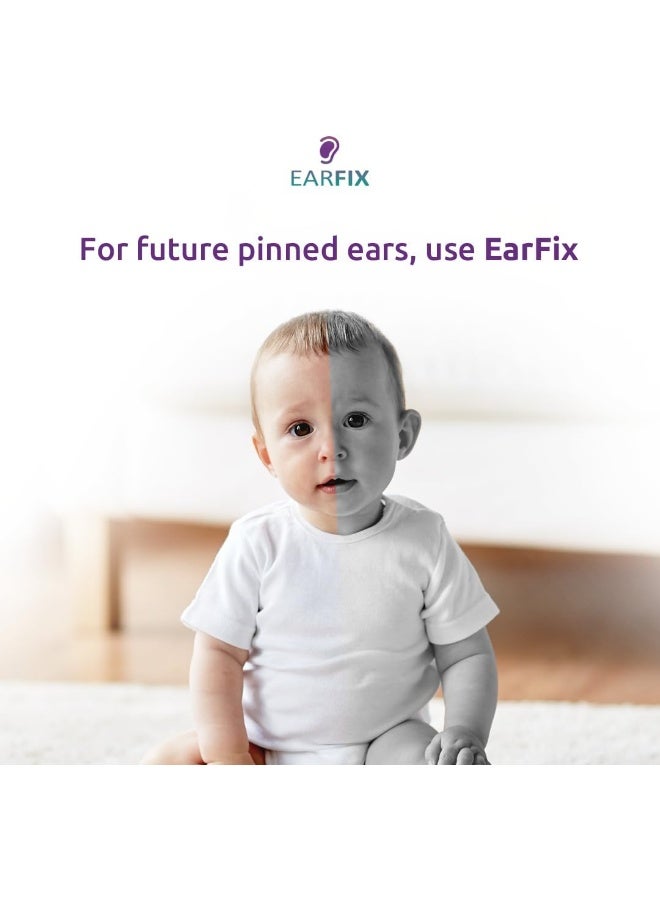 EarFix مصحح أذن الأطفال – 8 قطع ملصقات أذن لتثبيت الأذن – مصحح أذن للأطفال فوق 3 أشهر – ملصقات أذن مقاومة للماء للأذان البارزة، الأذان البارزة - Image 5