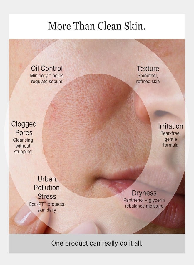 Keracell Pore Clearing Cleanser - Pore Cleanser & Minimizer with Salicylic Acid & Panthenol - Acne Cleansing Face Wash with MHCsc Technology - Moisturizes, Decreases Oil & Removes Impurities - 4 oz - Image 5