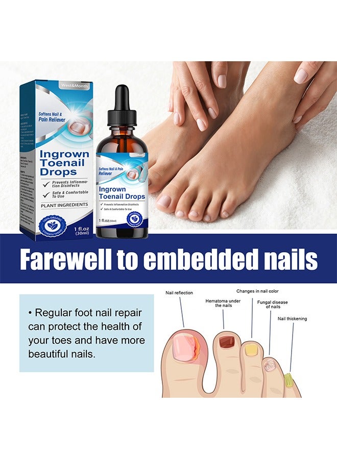 Ingrown Toenail Drops, Nail Care Essential Oil Cleans And Removes Gray Nails, Toe Nail Repair Treatment Extra Strength For Thick Nails Cracked Damaged Discolored