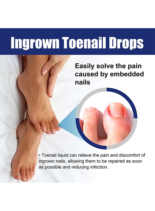 Ingrown Toenail Drops, Nail Care Essential Oil Cleans And Removes Gray Nails, Toe Nail Repair Treatment Extra Strength For Thick Nails Cracked Damaged Discolored