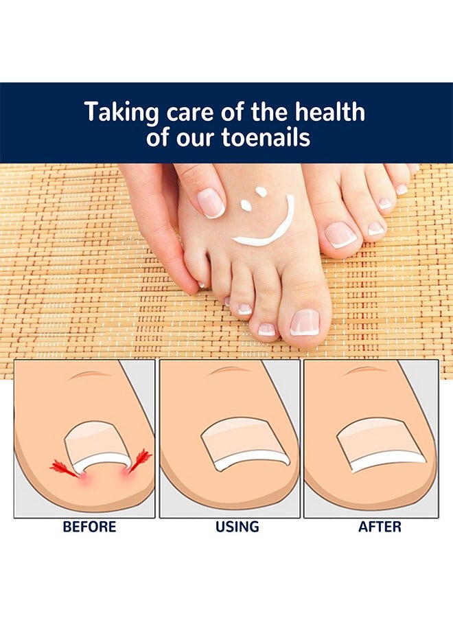 Ingrown Toenail Drops, Nail Care Essential Oil Cleans And Removes Gray Nails, Toe Nail Repair Treatment Extra Strength For Thick Nails Cracked Damaged Discolored