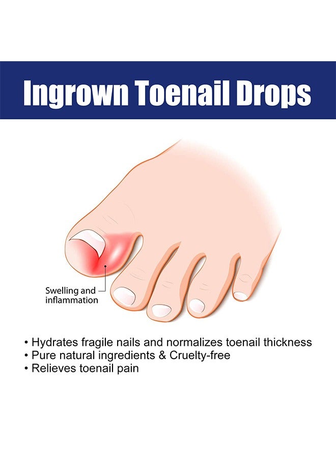 Ingrown Toenail Drops, Nail Care Essential Oil Cleans And Removes Gray Nails, Toe Nail Repair Treatment Extra Strength For Thick Nails Cracked Damaged Discolored