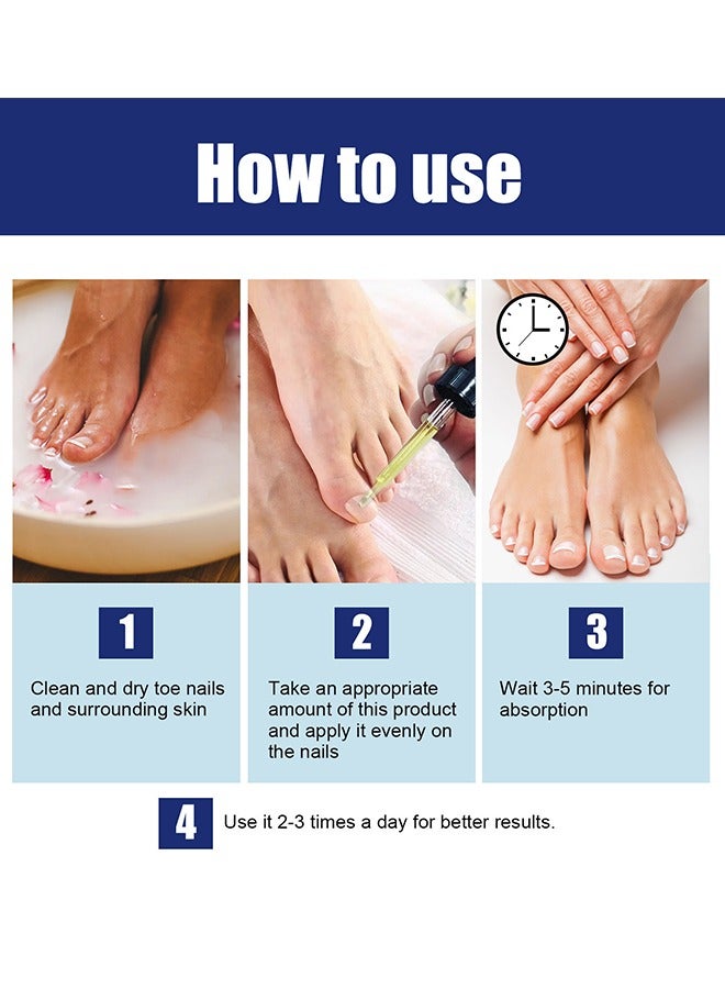 Ingrown Toenail Drops, Nail Care Essential Oil Cleans And Removes Gray Nails, Toe Nail Repair Treatment Extra Strength For Thick Nails Cracked Damaged Discolored