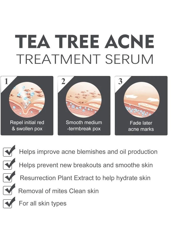 OUHOE - 30ml Acne Treatment Serum, Anti Acne Pores Shrink 2 Percent BHA Liquid Salicylic Acid Skin Rejuvenation Essence, Facial Exfoliant For Blackheads, Enlarged Pores, Wrinkles And Fine Lines - Image 1