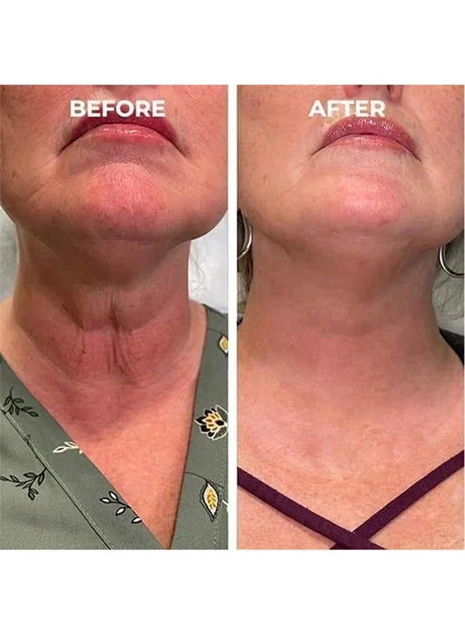 إيلهو مصل الوجه بحمض الهيالورونيك ، سيروم شد البشرة ، سيروم شد البشرة ، سيروم شد البشرة للوجه والرقبة ، سيروم شد البشرة للوجه والرقبة لجميع أنواع البشرة 80 مل - Image 4