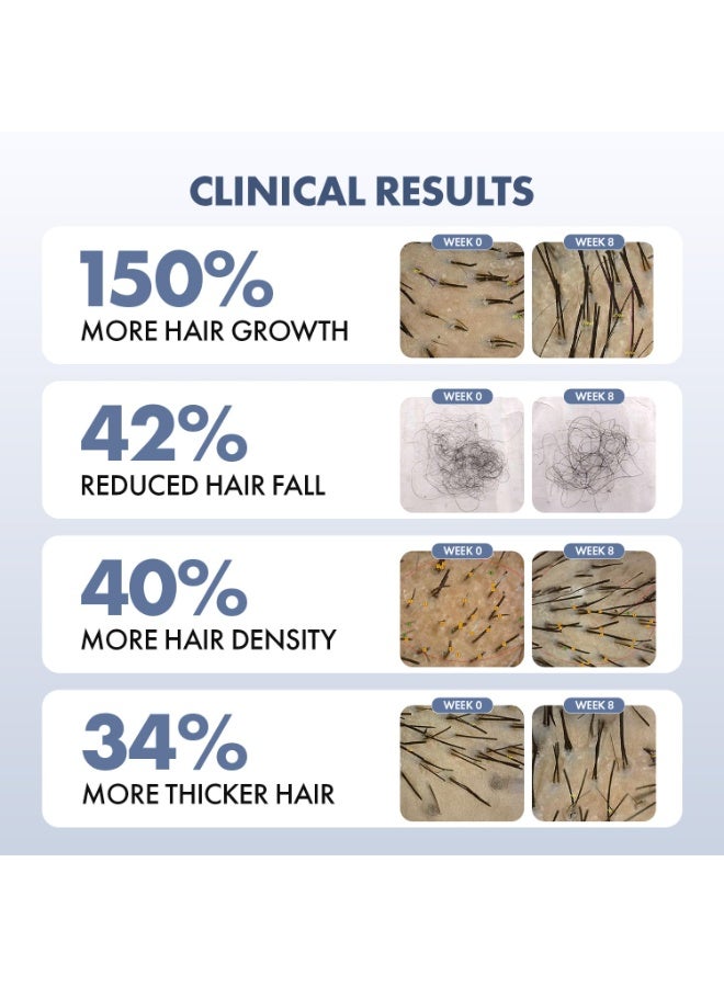 ثريفيكو سيروم ثرايف كو لنمو الشعر 2.0 لتعزيز نمو الشعر والتحكم في تساقطه | يحتوي على ريدنسيل + أناجين + إكليل الجبل + بروكابيل + كابيليا لونغا | مناسب للرجال والنساء (10 مل (عبوة واحدة)) - Image 4