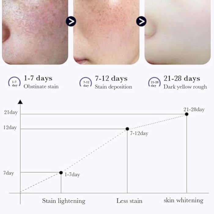 paminify مزيل البقع الداكنة للوجه، كريم تفتيح النمش بالنيكوتيناميد، كريم تفتيح الجسم للبشرة الباهتة، نتائج مرئية خلال 28 يومًا، نعومة الكلف، مصحح البقع الداكنة الناتجة عن فرط التصبغ، 0.7 أونصة - Image 3