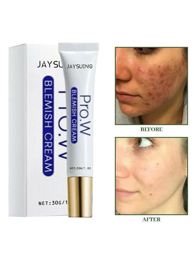 Jaysuing Blemish Cream, Facial Oil Control Acne Cream, for Fast Acne Removal for Oily and Acne-prone Skin, Non-Irritant, Women 30g - Image 1