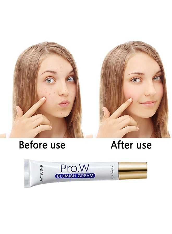 Jaysuing Blemish Cream, Facial Oil Control Acne Cream, for Fast Acne Removal for Oily and Acne-prone Skin, Non-Irritant, Women 30g - Image 3