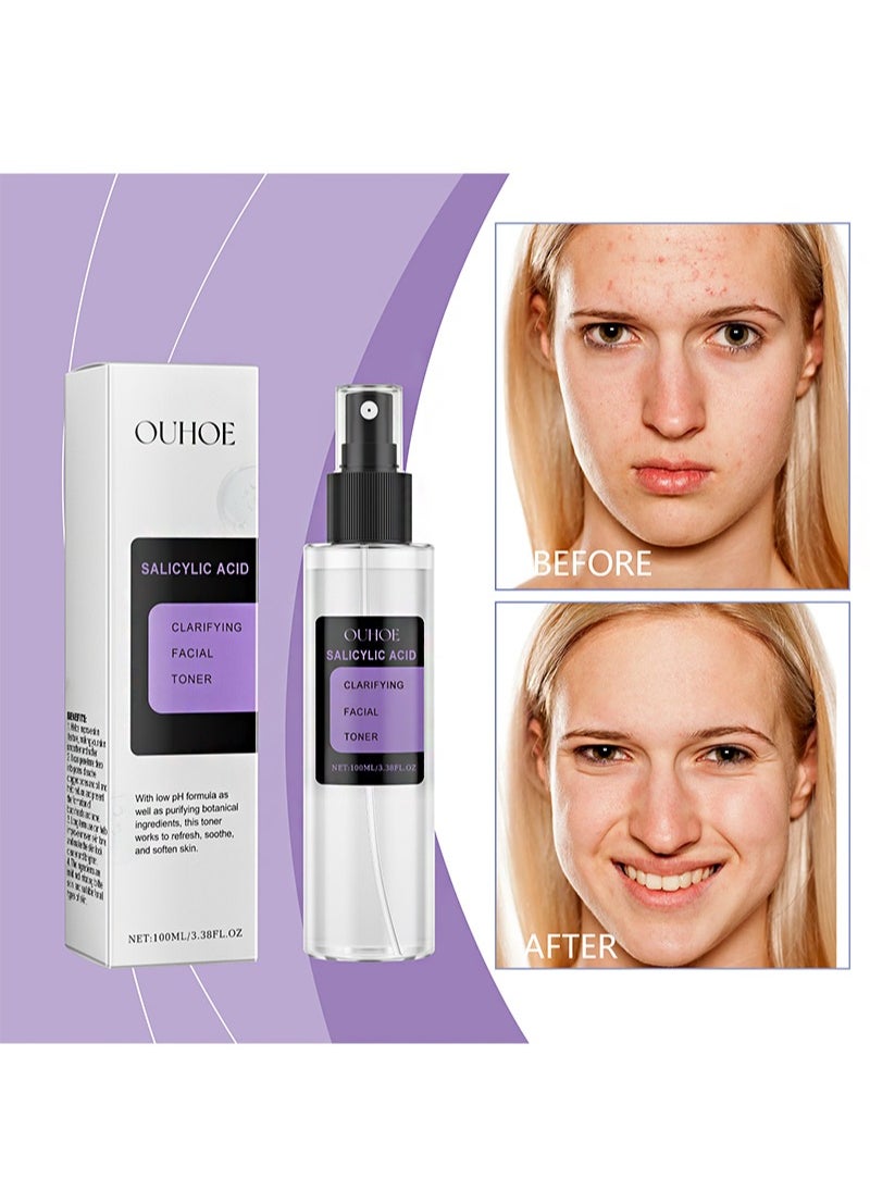 OUHOE - Salicylic Acid Toner Spray，Improve skin radiance, for acne and clear skin, oily skin, problem skin, natural, vegan, sebum and dead skin cleanser (100ml) - Image 1