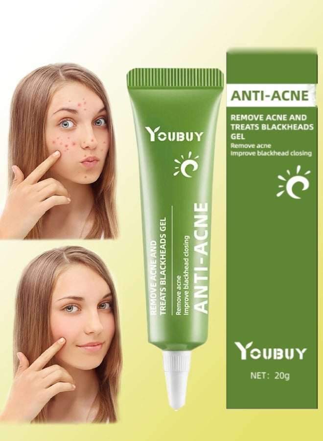 YOUBUY Anti Acne Remove Acne and Treats Blackheads Gel for Day Use Remove Acne Pimple and Treats Blackhead with Azelaic Acid Oil Control Shrink Pores Redness Relief Skin Lightening Scar Fade Cream Acne Remover Cream 20g - Image 1