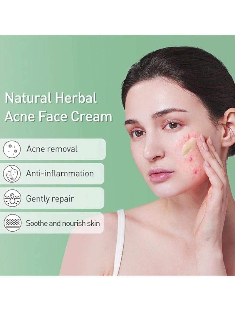 YOUBUY Anti Acne Remove Acne and Treats Blackheads Gel for Day Use Remove Acne Pimple and Treats Blackhead with Azelaic Acid Oil Control Shrink Pores Redness Relief Skin Lightening Scar Fade Cream Acne Remover Cream 20g - Image 2