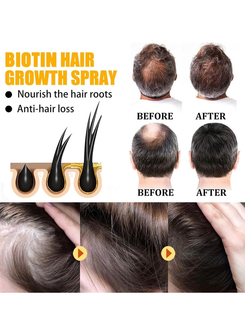 Biotin Hair Growth Spray, Biotin Hair Growth Serum, Hair Growth Serums, Nourishing Hair Spray, Prevention of Hair Loss, Biotin Hair Loss Oil, Hair Growth Essential Oils, Nourishes Hair and Scalp (1PC)