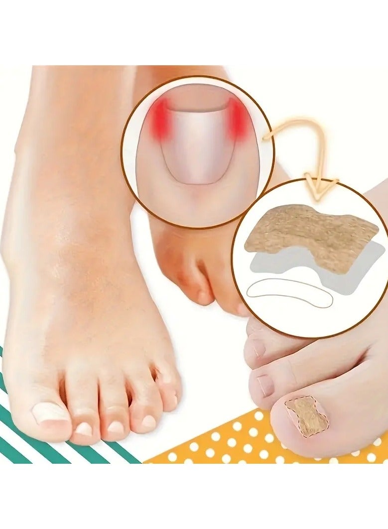 ORiTi 10 sheet  Ingrown Toenail Corrector Patch,Ingrown Toenail Corrector Strips Toenail Correction Patches Ingrown Toenail Treatment Tool Foot Care No Glue Painless Toenail Correction Stickers - Image 2