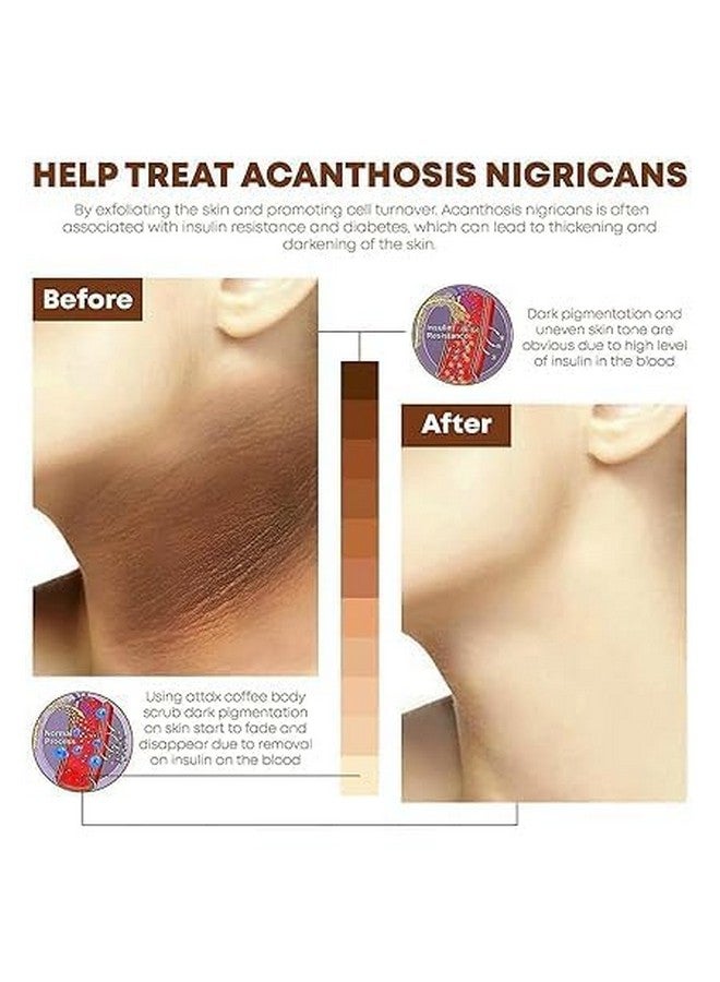 ADOERE سكراب تقشير الوجه والجسم ADOERE | مقشر تنظيف عميق | سكراب لإزالة الجلد الميت والرؤوس السوداء | لجميع أنواع البشرة (360 مل، ذهب 24 قيراط)  - Image 4