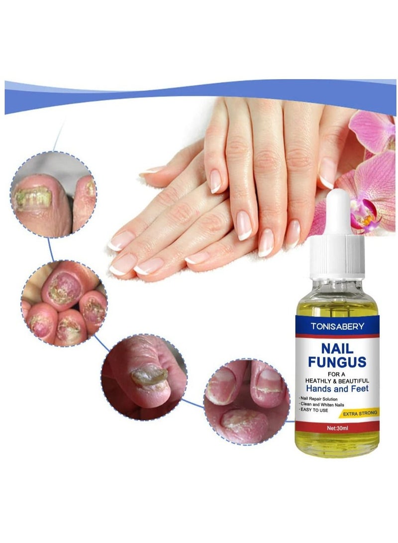 TONISABERY محلول فطريات الأظافر للأظافر المتشققة والمتغيرة اللون، طبيعي آمن، إصلاح فعال ويحمي، يزيل التهابات الأظافر، سائل مغذي لليدين والقدمين، لا يسبب أي آثار جانبية، تهيج للجنسين، 30 مل - Image 5