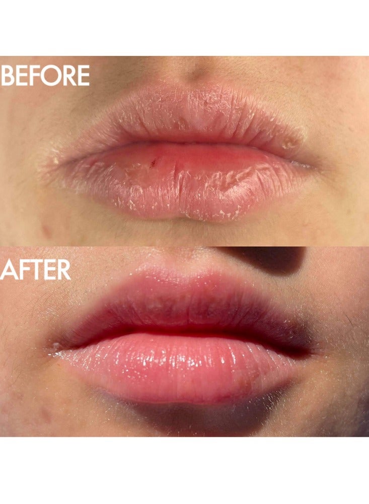 Lanolips Lano Lips – The Original 101 Ointment Multipurpose Super Balm (15g) - Image 4