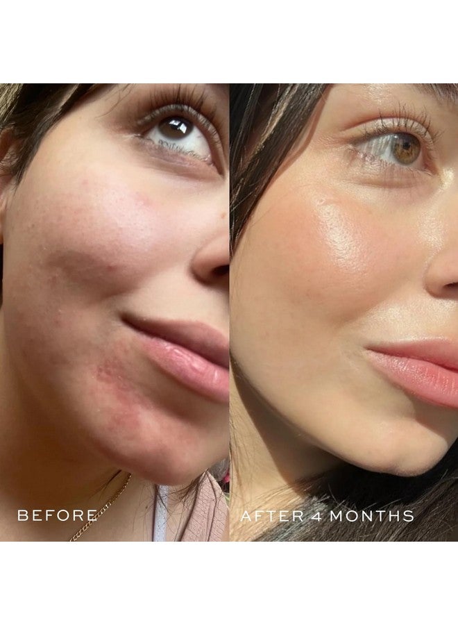 DIME Beauty Blue Facial Oil, Blemish Spot Treatment with Blue Tansy Oil, Black Cumin Seed Oil, Rosehip Oil, and Grapeseed Oil, 1 oz / 30 mL - Image 3