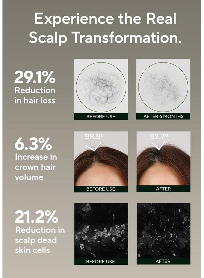 AROMATICA Rosemary Salt Scrub Shampoo - Hair Loss Korean Scalp Detox Shampoo with Rosemary Scalp Oil | Scalp Exfoliator with Salt Scrub for Oily Scalp | Sulfate Free, Silicone Free (10.5 oz / 300g) - Image 3