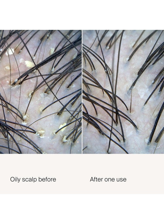 Living Proof Scalp Care Exfoliator - Image 2