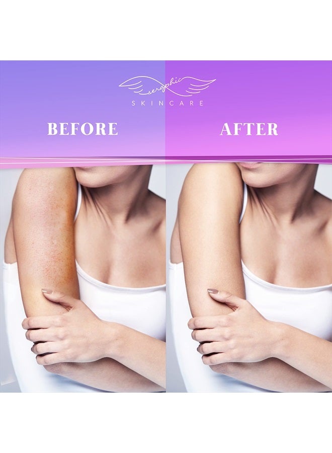 Seraphic Skincare Seraphic Skincare Korean Exfoliating Mitts (1pc) Microdermabrasion at Home, Exfoliating Gloves Visibly Lift Away Dead Skin, Great for Spray Tan Removal or Keratosis Pilaris, Made of 100% Viscose Fiber - Image 3