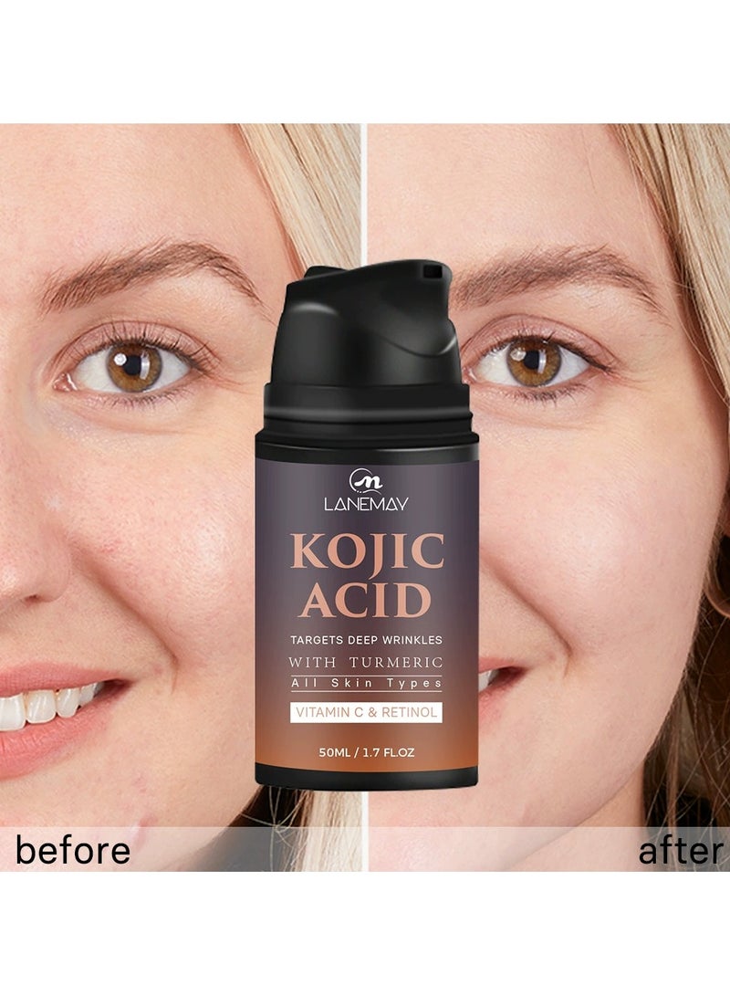 LANEMAY كريم وجه فيتامين سي وحمض كوجيك وريتينول – مرطب مضاد للشيخوخة مشدّد ومضيء وإصلاح التجاعيد للعناية بالبشرة - Image 3